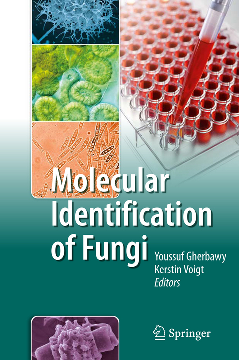 Molecular Identification of Fungi - 