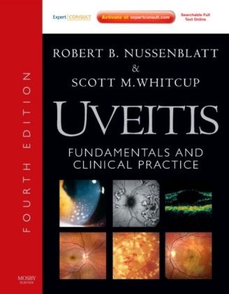 Uveitis - Robert B. Nussenblatt, Scott M. Whitcup