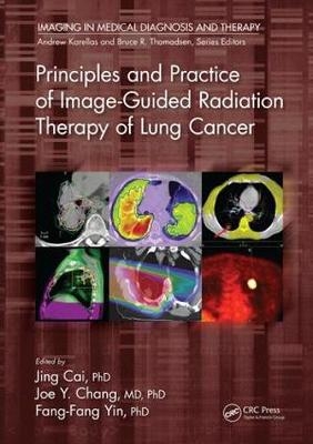 Principles and Practice of Image-Guided Radiation Therapy of Lung Cancer - 