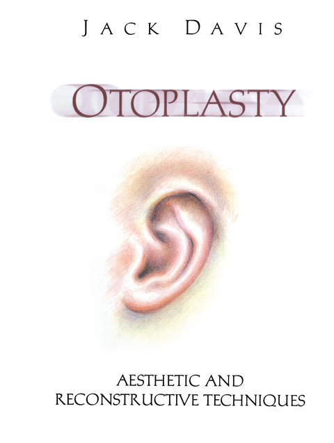 Otoplasty - Jack Davis