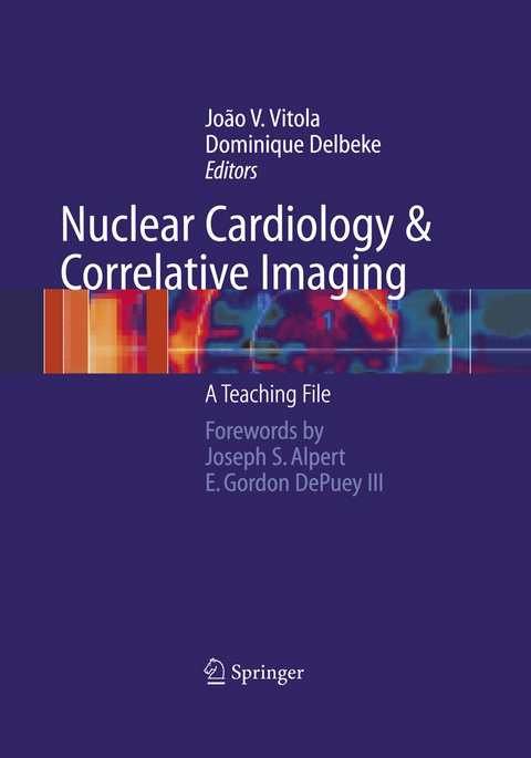 Nuclear Cardiology and Correlative Imaging - 