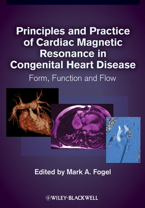 Principles and Practice of Cardiac Magnetic Resonance in Congenital Heart Disease - 