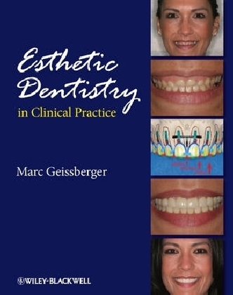 Esthetic Dentistry in Clinical Practice - Marc Geissberger