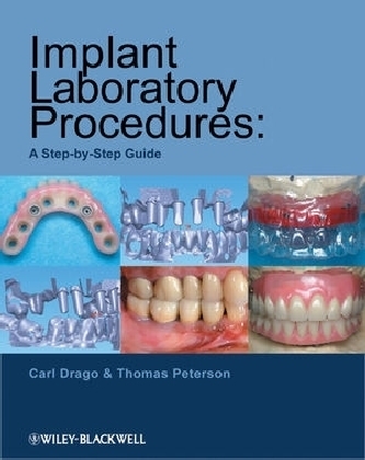 Implant Laboratory Procedures - Carl Drago, Thomas Peterson