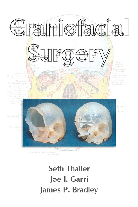 Craniofacial Surgery - 