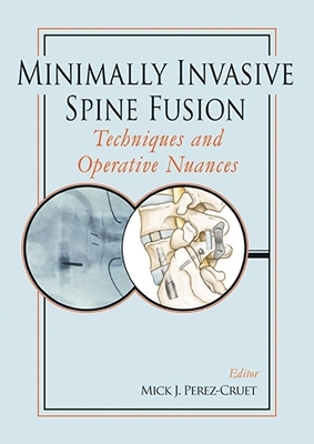 Minimally Invasive Spine Fusion: Techniques and Operative Nuances - 