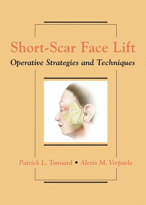 Short-Scar Face Lift - Patrick Tonnard, Alexis Verpaele