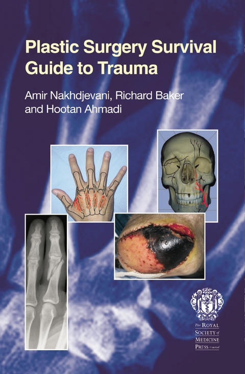 Plastic Surgery Survival Guide to Trauma - Amir Nakhdjevanind, Hootan Ahmadi