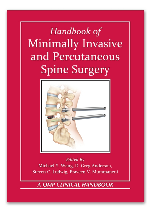 Handbook of Minimally Invasive and Percutaneous Spine Surgery - 