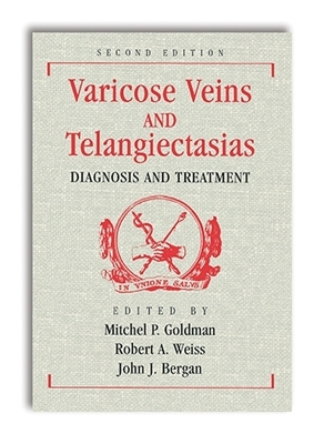 Varicose Veins and Telangiectasias: Diagnosis and Treatment, Second Edition - 