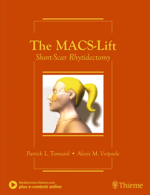 The MACS-Lift - Patrick Tonnard, Alexis Verpaele