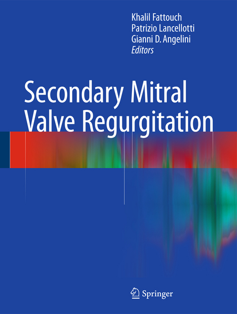 Secondary Mitral Valve Regurgitation - 