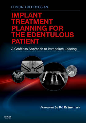 Implant Treatment Planning for the Edentulous Patient - Edmond Bedrossian