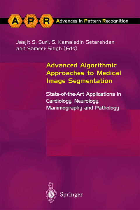 Advanced Algorithmic Approaches to Medical Image Segmentation - 