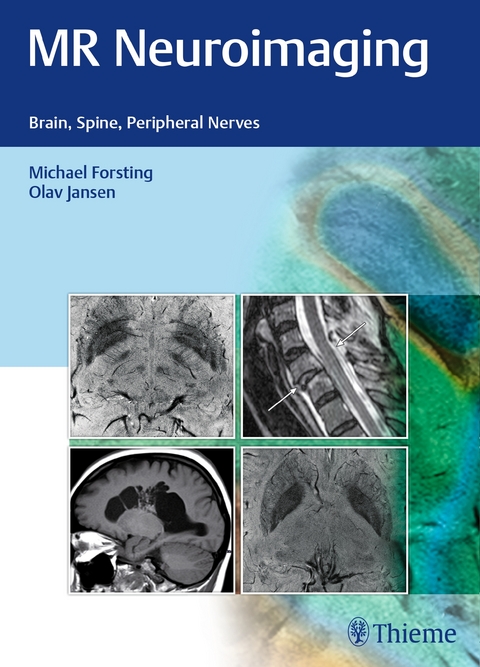 MR Neuroimaging - 