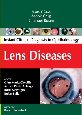 Lens Diseases - Gian Maria Cavallini, Arturo Perez Arteaga, Boris Malyugin, Bojan Pajic