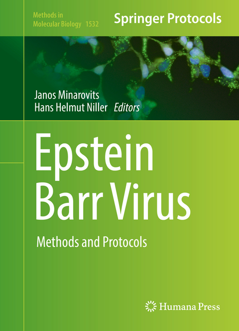 Epstein Barr Virus - 