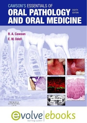 Cawson's Essentials of Oral Pathology and Oral Medicine - Roderick A. Cawson, Edward W. Odell