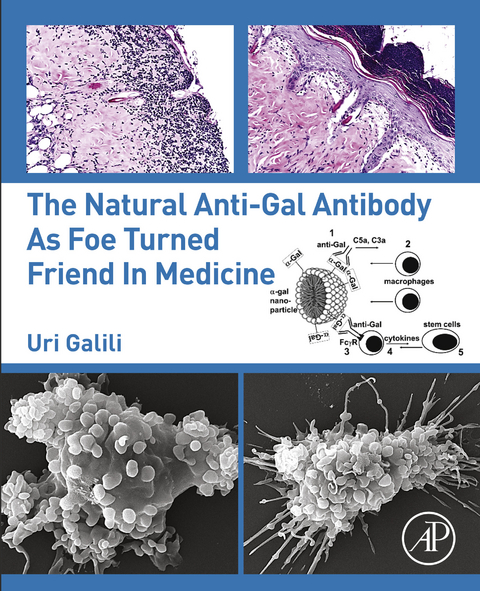 Natural Anti-Gal Antibody as Foe Turned Friend in Medicine -  Uri Galili