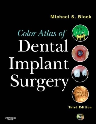Color Atlas of Dental Implant Surgery - Michael S. Block