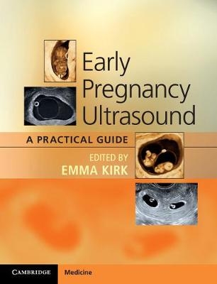 Early Pregnancy Ultrasound - 
