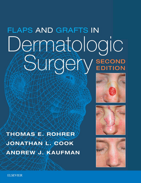 Flaps and Grafts in Dermatologic Surgery -  Jonathan L. Cook,  Andrew Kaufman,  Thomas E. Rohrer