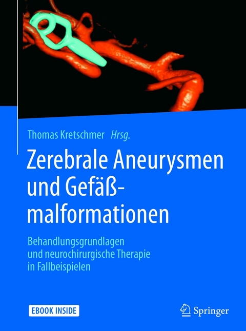 Zerebrale Aneurysmen und Gefäßmalformationen - 