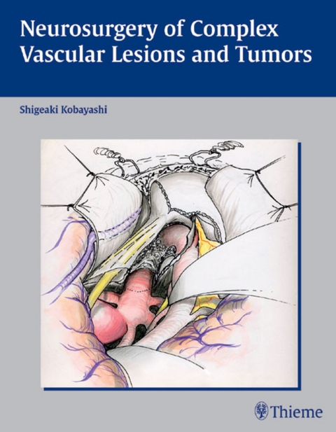 Neurosurgery of Complex Vascular Lesions and Tumors - 