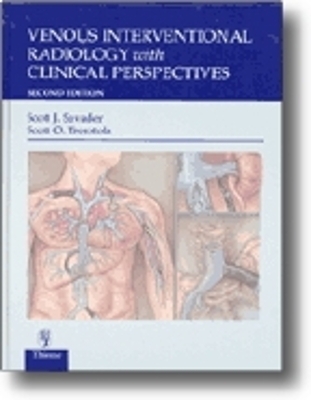 Venous Interventional Radiology With Clinical Perspectives - 