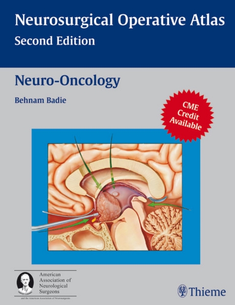 Neuro-Oncology - 