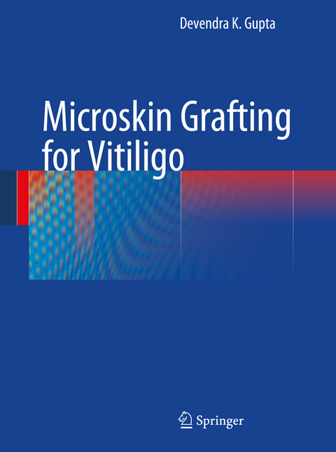 Microskin Grafting for Vitiligo - Devendra K. Gupta