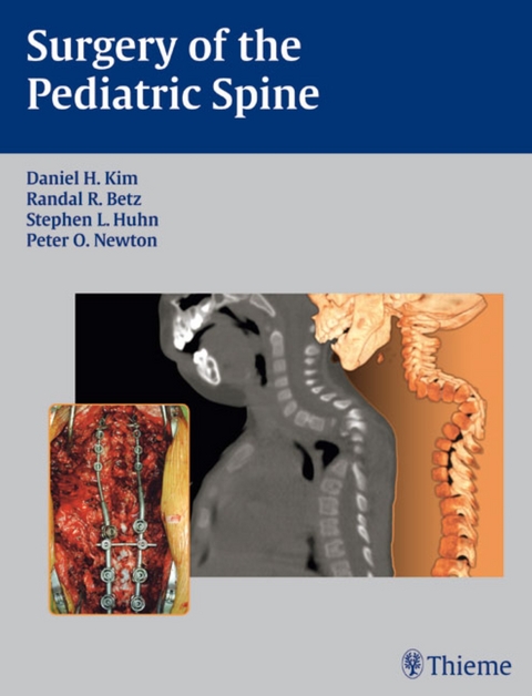 Surgery of the Pediatric Spine - Lawrence G Lenke