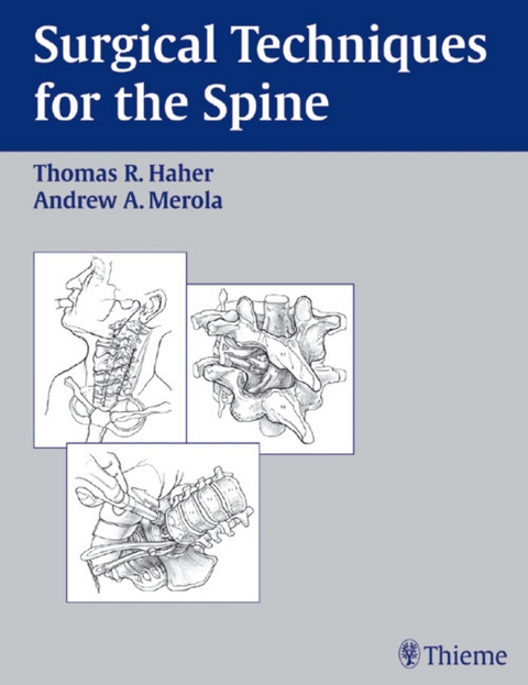 Surgical Techniques for the Spine - 