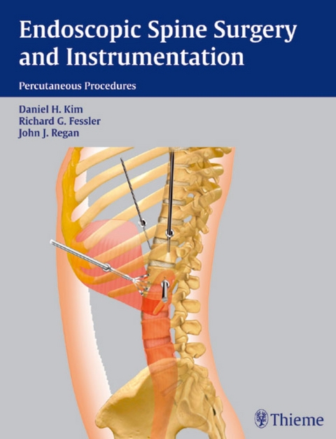 Endoscopic Spine Surgery and Instrumentation - 