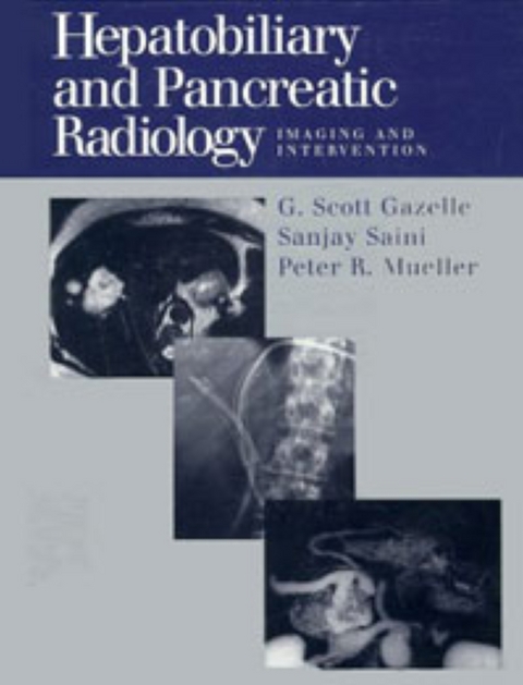 Hepatobiliary and Pancreatic Radiology - 