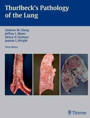 Thurlbeck's Pathology of the Lung - Andrew M. Churg, Jeffrey L. Myers, Henry D. Tazelaar, Joanne L. Wright