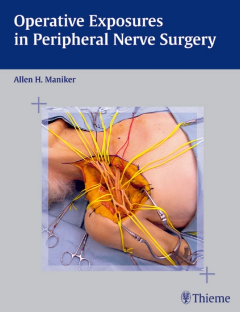 Operative Exposures in Peripheral Nerve Surgery - 