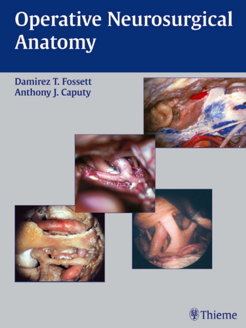 Operative Neurosurgical Anatomy - Damirez T. Fossett, Anthony J. Caputy