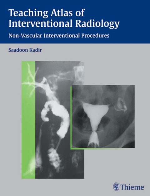 Teaching Atlas of Interventional Radiology - 