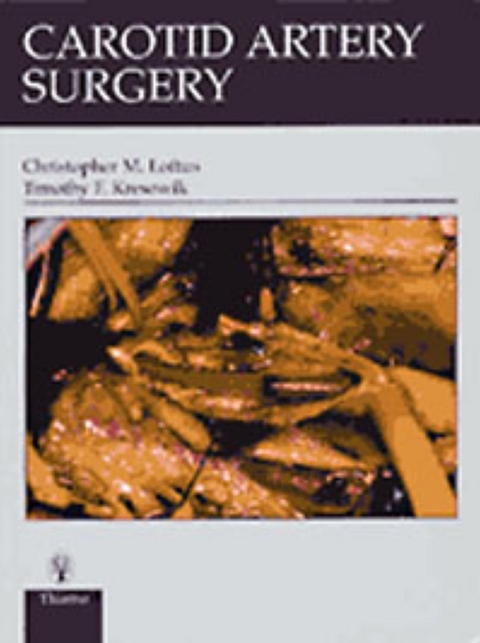 Carotid Artery Surgery - Christopher Loftus, Timothy F. Kresowik
