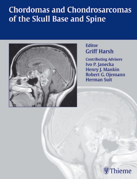 Chordomas and Chondrosarcomas of the Skull Base and Spine - 