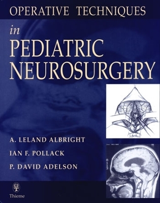 Operative Techniques in Pediatric Neurosurgery - A. Leland Albright, Ian F. Pollack, P. David Adelson