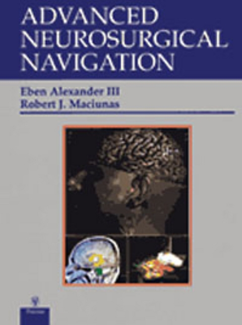 Advanced Neurosurgical Navigation - 