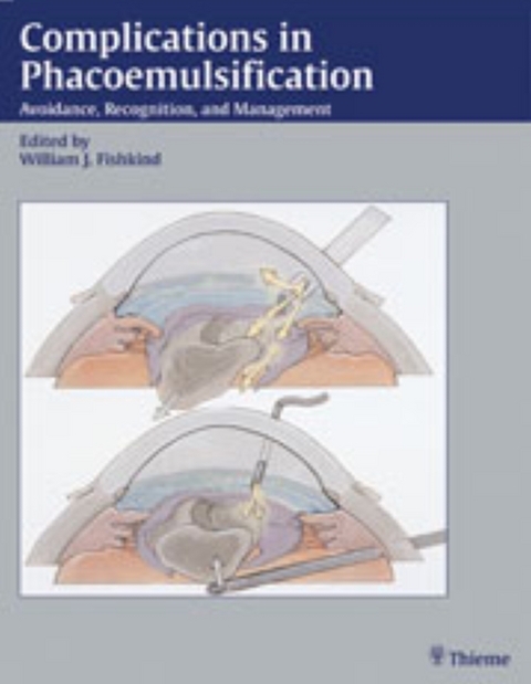 Complications in Phacoemulsification - William J Fishkind