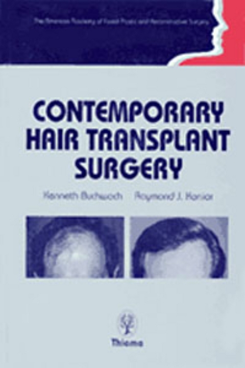 Contemporary Hair Transplant Surgery - Kenneth A. Buchwach, Raymond J. Konior