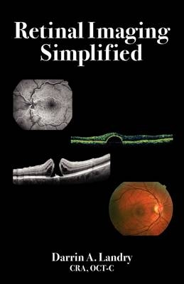 Retinal Imaging Simplified - Darrin A Landry