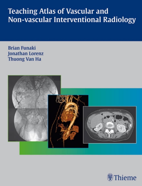 Teaching Atlas of Vascular and Non-vascular Interventional Radiology - Brian Funaki, Jonathan M. Lorenz, Thuong G. Van Ha