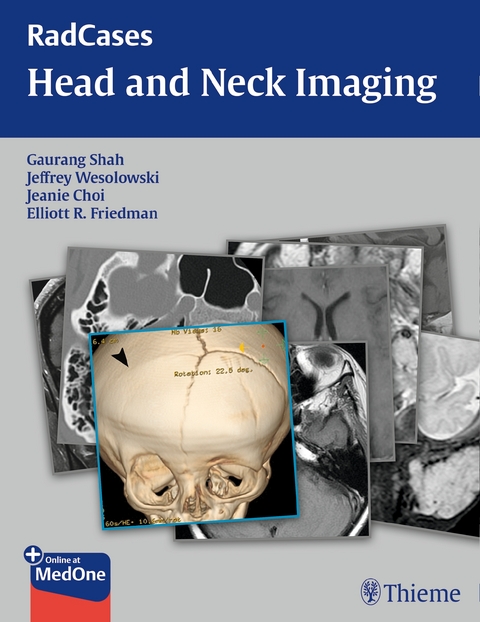 RadCases Head and Neck Imaging - 