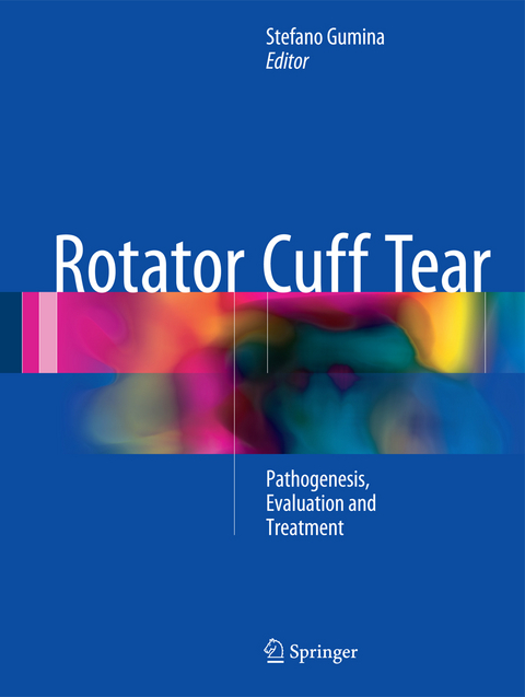 Rotator Cuff Tear - 
