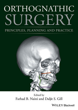 Orthognathic Surgery - 